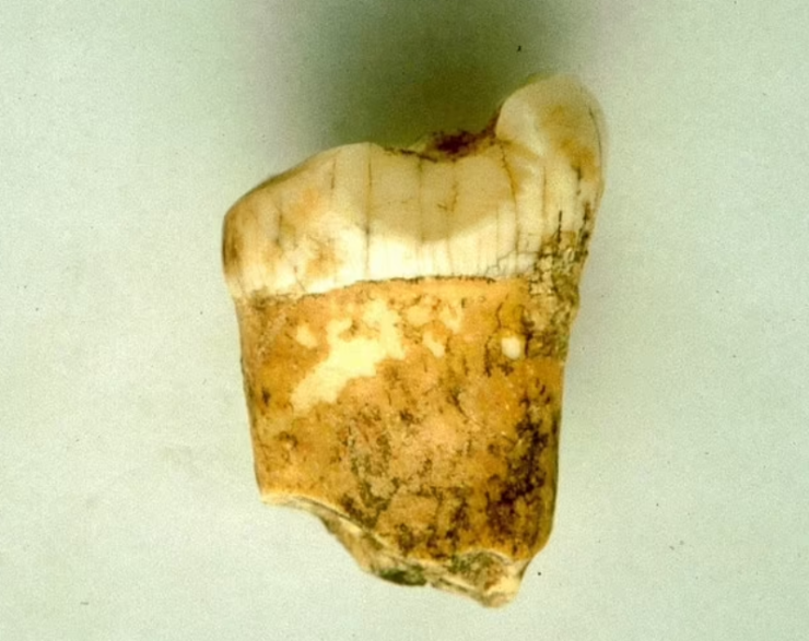 Neanderthals may have been carnivores, based on their tooth enamel