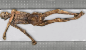 Also known as the naturally mummified Ice man, Ötzi.